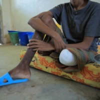 Filimon, 18, a captured fighter from the Tigray People\'s Liberation Front, sits in a guarded hospital room in Dubti Referral Hospital in Ethiopia on Feb. 24 | REUTERS
