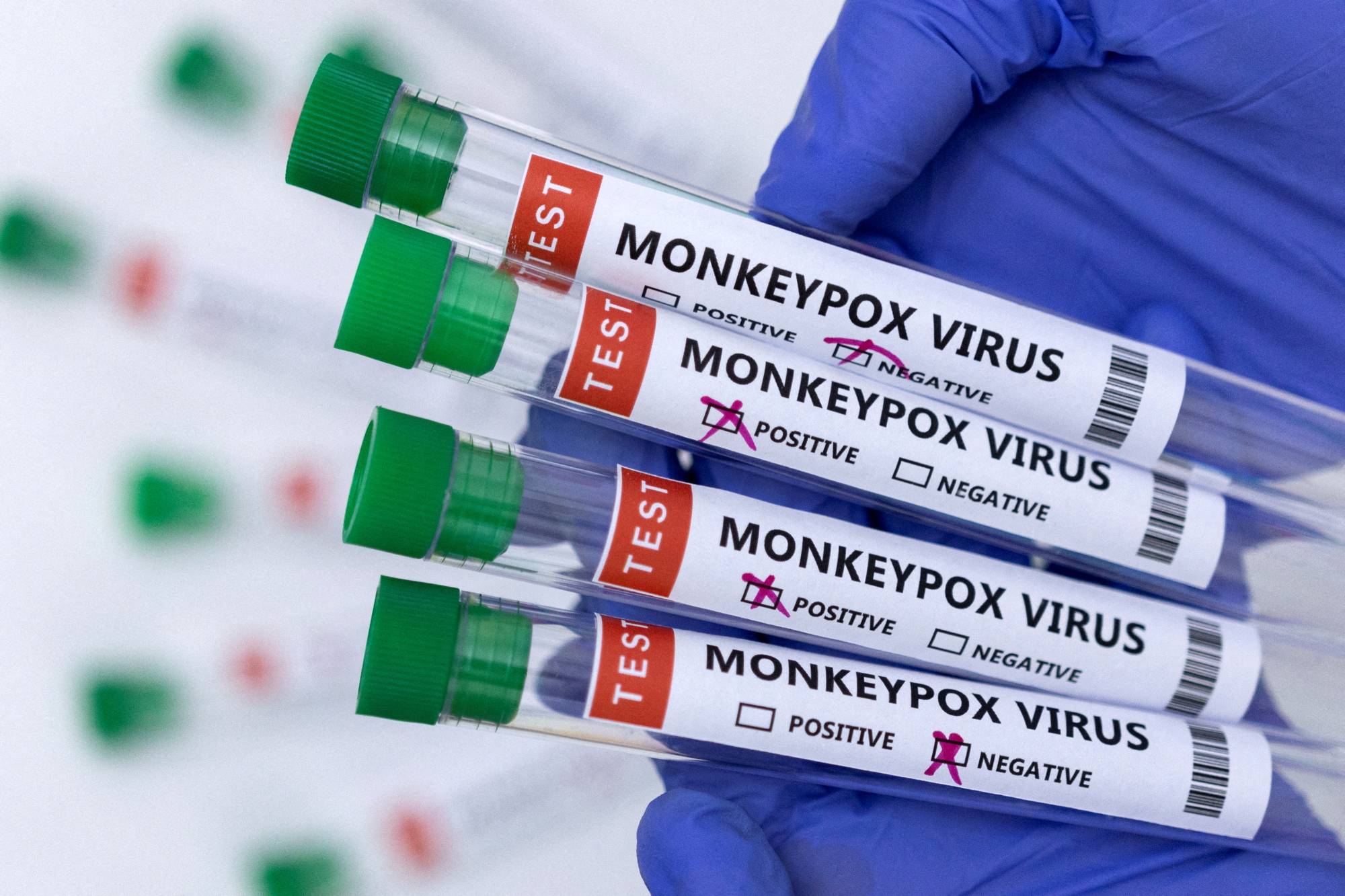 While no monkeypox cases have been found so far in Japan, the health ministry this week requested that municipalities nationwide step up surveillance and report any suspected cases. | REUTERS