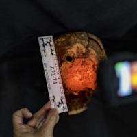 Raquel Fortun, a forensic pathologist, photographs a hole that she says is consistent with a gunshot wound in the back of a skull of a man killed during President Rodrigo Duterte\'s drug war, in Manila on May 17. Fortun, one of only two forensic pathologists in the Philippines, is using her skills to show how other doctors falsely claimed some victims of the country’s drug war had died natural deaths. | EZRA ACAYAN / THE NEW YORK TIMES