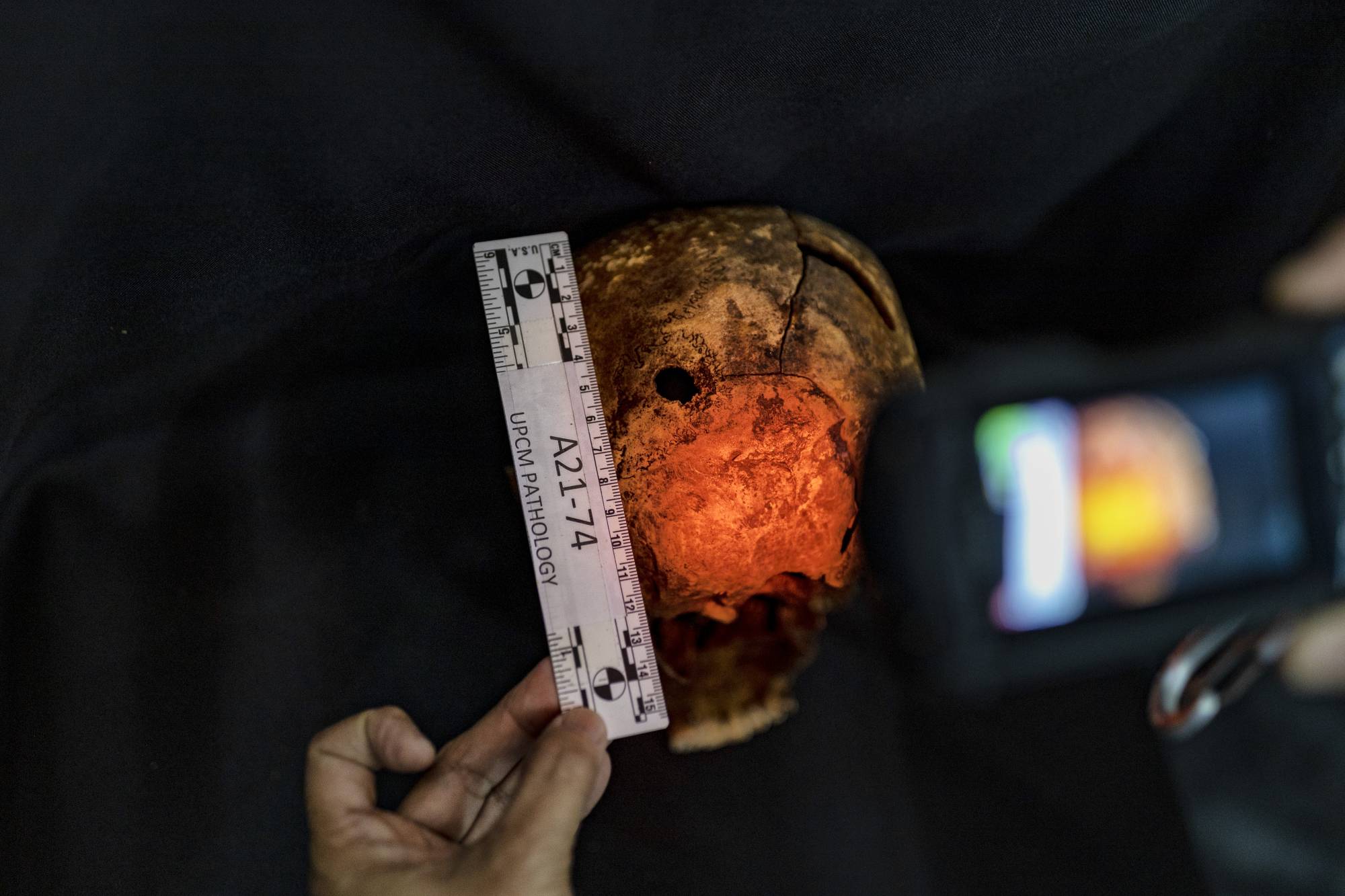 Raquel Fortun, a forensic pathologist, photographs a hole that she says is consistent with a gunshot wound in the back of a skull of a man killed during President Rodrigo Duterte's drug war, in Manila on May 17. Fortun, one of only two forensic pathologists in the Philippines, is using her skills to show how other doctors falsely claimed some victims of the country’s drug war had died natural deaths. | Ezra Acayan / The New York Times