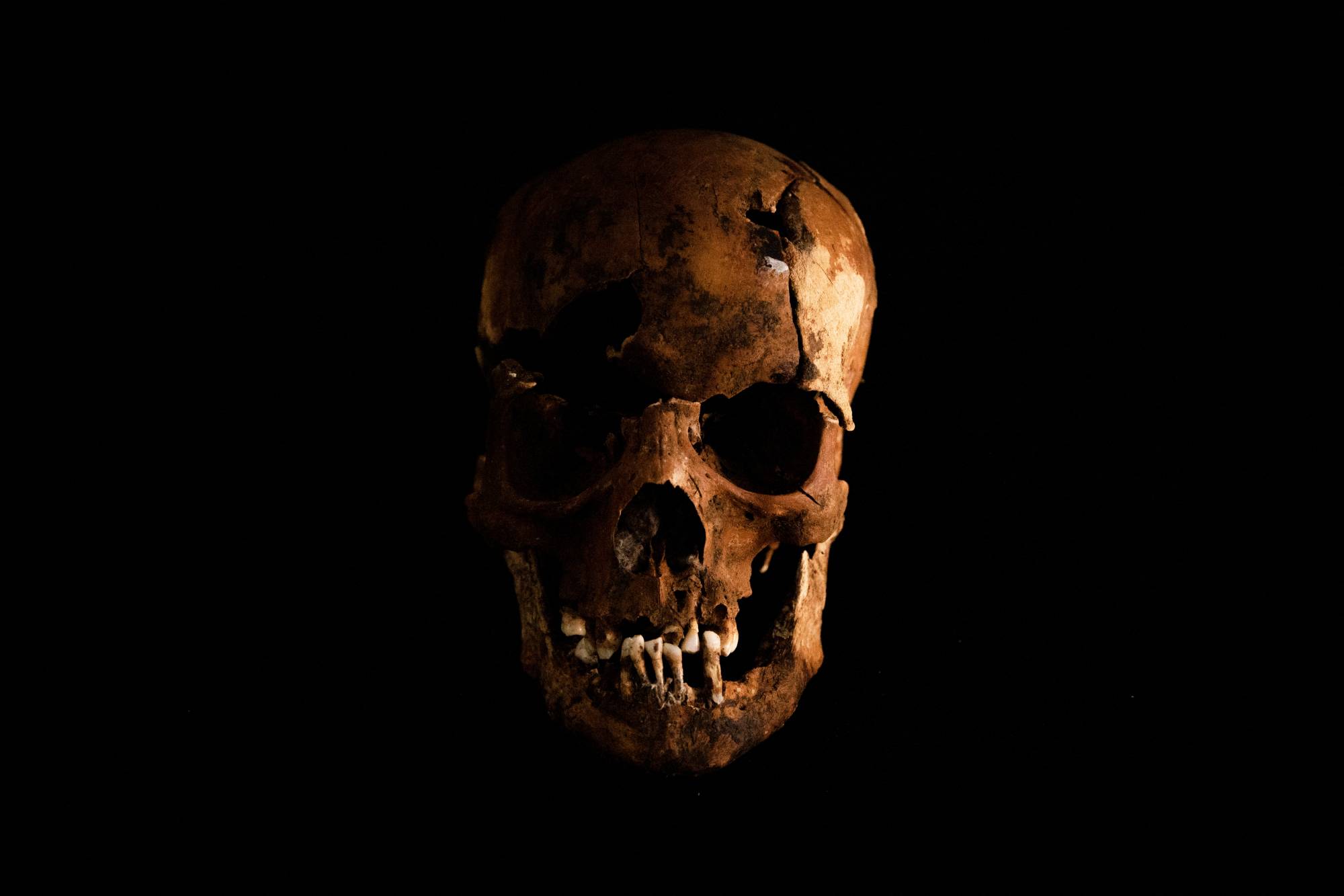 The exhumed skull of Crisanto Abliter, a drug war victim, is photographed at the University of the Philippines in Manila last December. | REUTERS
