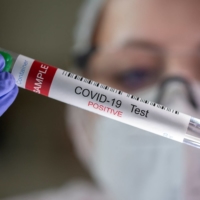 The results of a June survey by the U.S. Census shed light on how frequently the COVID-19 symptoms linger beyond the initial period when people are acutely sick. | REUTERS