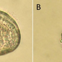 Microscopic images of Pacific oyster larvae from a 2007 paper authored by marine scientist Haruko Kurihara. Larva A — which was placed in seawater with a pH of 8.1, the same as the global average for surface seawater — grew normally, while larva B, incubated in more acidic seawater with a pH level of 7.4, did not. | COURTESY OF HARUKO KURIHARA
