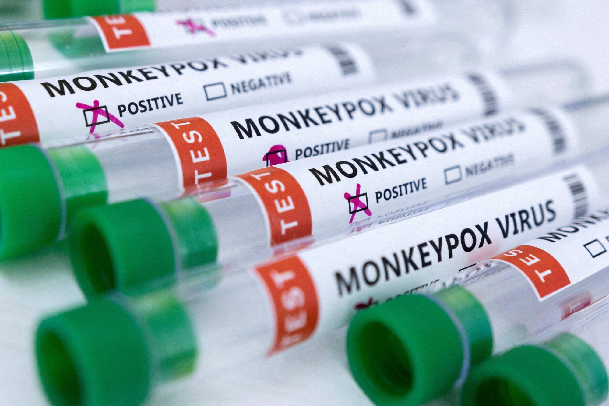 Japan held the nation’s first emergency meeting on monkeypox Monday and decided to step up surveillance and preventive measures. | REUTERS