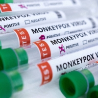 China reported its first case of monkeypox on Friday in Chongqing. | REUTERS
