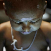 S. Saksan, 5, who has been diagnosed with leukaemia, rests at a cancer care transit home near a hospital in Colombo, Sri Lanka, in August.  | REUTERS