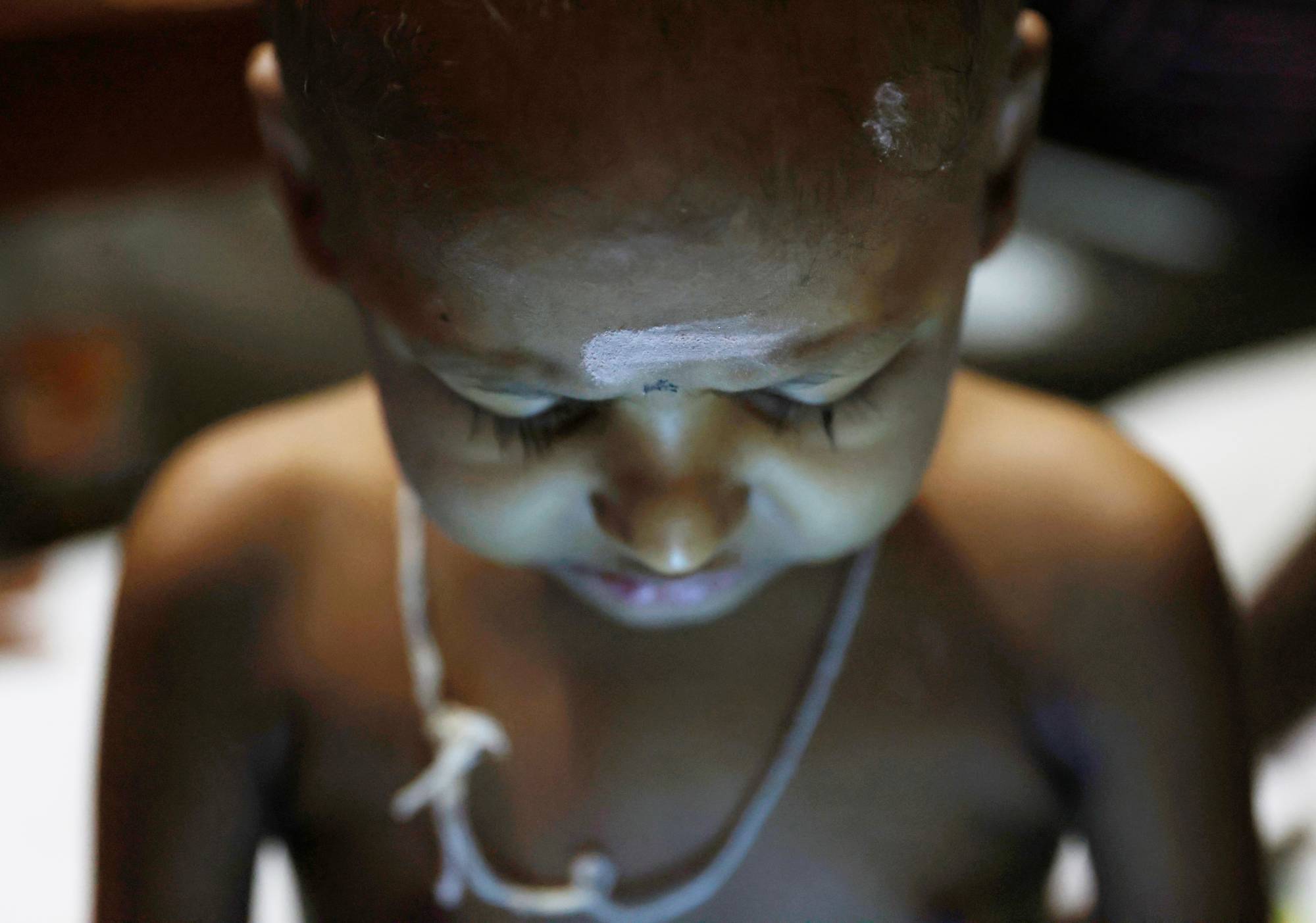 S. Saksan, 5, who has been diagnosed with leukaemia, rests at a cancer care transit home near a hospital in Colombo, Sri Lanka, in August.  | REUTERS