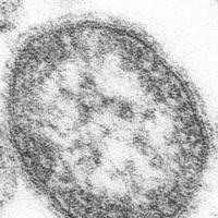 A microscopic image of the measles virus | CDC/PHIL
