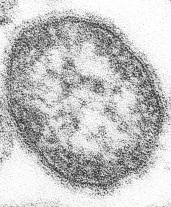 A microscopic image of the measles virus | CDC/PHIL
