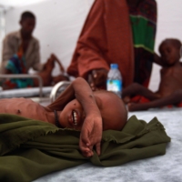 Children receive medical treatment at a field hospital in Mogadishu, Somalia. The lingering fallout from the pandemic and Russia’s war in Ukraine means about 735 million people went undernourished in 2022.
 | GETTY IMAGES / VIA BLOOMBERG