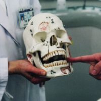Toothy grin: This dental training skull has more teeth than a human mouth, and is used to indicate connections between the teeth and nerve centers. | KEVIN RAFFERTY PHOTOS