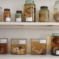 Every parent\'s nightmare:  The bodies of deformed babies in formaldehyde line the walls of a room at  Tu Du Hospital in Ho Chi Minh City.  The grim specimens are kept as a record of the effects of the toxic herbicide Agent Orange, which was sprayed in huge quantities by U.S. forces over  Vietnam in the 1960s and \'70s. | JON MITCHELL