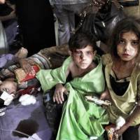 Faces of the conflict: Syrian children wounded in regime airstrikes are treated in the town of Azaz on the outskirts of Aleppo last August. | AP