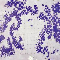 Natsuyuki Nakanishi\'s \"Behind, Circle &#8212; I 05\" (2005) | SCAI THE BATHHOUSE