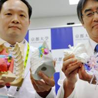 Kyoto University Hospital surgeon Hiroshi Date (right) and an unidentified co-worker show off human organ models made by 3-D printers Wednesday in the city of Kyoto. Date\'s medical team used the models to assist in a successful partial transplant of a lung between a married couple in their 40s in March. | KYODO