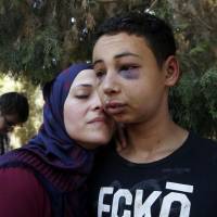 Tariq Khdeir is greeted by his mother after being released from jail in Jerusalem Sunday. Tariq Khdeir from Tampa, Florida, is a cousin of Mohammed Abu Khudeir, 16, whose abduction and killing in Jerusalem on Wednesday sparked violent protests and calls from Palestinians for a new uprising against Israel. | REUTERS