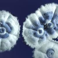 Streptomyces coelicolor, source of the antibiotic streptomycin, is seen in a photo released in London. Many bacteria haven\'t yet been examined for their bug-killing capacity. | REUTERS
