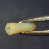 This vascular tissue was generated with a bio 3D printer. | CYFUSE BIOMEDICAL K.K.
