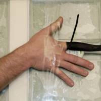 Researchers prepare a study participant\'s finger for joint cracking at the University of Alberta\'s Peter S. Allen MR Research Centre in Edmonton. | REUTERS