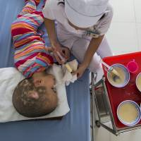 Pham Thi Phuong Khanh is fed by a hospital staff member at the Peace Village in Tu Du hospital in Ho Chi Minh City on April 14. Both of Pham Thi Phuong Khanh\'s parents were exposed to Agent Orange during the Vietnam War. | REUTERS