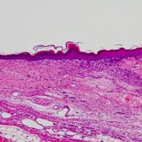A cross-section of skin that healed after a bandage of artificial skin was applied.  | COURTESY OF SAGA UNIVERSITY