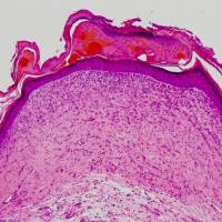 A cross-section through a wound treated only with a bandage.  | COURTESY OF SAGA UNIVERSITY