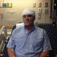 Chase Dellwo, 26, poses for a photo at Benefis Health System in Great Falls, Montana, Sunday. The bow hunter in Teton County is recovering after he survived a grizzly bear mauling by remembering a tip from his grandmother and shoving his arm down the animal’s throat. 'Bad gag reflexes': Montana bow hunter recalls grandma's tip, shoves arm down grizzly's throat to scare it off