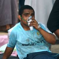 A man is treated outside the Jazan General Hospital after a blaze broke out in the intensive care unit and the maternity department on Thursday in the kingdom\'s south Jizan province. | DIRECTORATE OF THE SAUDI CIVIL DEFENSE / HO / AFP-JIJI