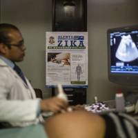 A poster with information about the Zika virus hangs on a wall as a pregnant woman undergoes an ultrasound treatment at the Social Security Institute maternity ward in Guatemala City on Tuesday,. The Zika virus is spreading explosively in Latin America along with a spike in cases of microcephaly, a birth defect that causes babies to be born with abnormally small heads. | BLOOMBERG