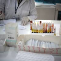 Lab technicians analyze blood of pregnant women at the maternity of the Guatemalan Social Security Institute (IGSS) in Guatemala City on Tuesday. Guatemala increased the monitoring of pregnant women because of the risk of infection by Zika virus. World health officials mobilized with emergency response plans and funding pleas Tuesday as fears grow that the Zika virus, blamed for a surge in the number of brain-damaged babies, could spread globally and threaten the Summer Olympics. | AFP-JIJI