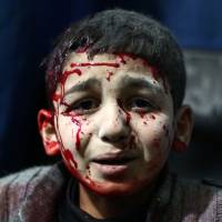 An injured Syrian child waits for treatment at a makeshift hospital in the rebel held area of Douma, northeast of Damascus, following reported airstrikes by forces loyal to President Bashar Assad in February 2015. | AFP-JIJI