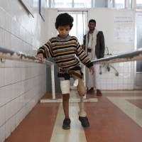 A young boy who lost his leg in the Yemeni civil war uses a prosthetic limb at a government-run rehabilitation center in Sanaa on March 5. An infant's short life points to the spread of hunger in Yemen