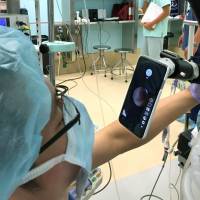 A system developed by Microscope Network Co. and the University of Tsukuba enables doctors to check endoscope images on iPhones and a large monitor. | UNIVERSITY OF TSUKUBA / KYODO