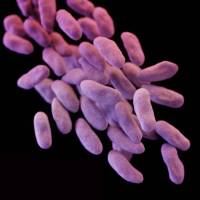 These Enterobacteriaceae bacteria are resistant to even the \"last resort\" carbapenem antibiotics. | AP