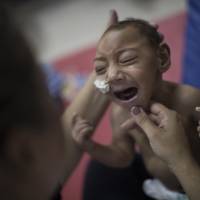One-year-old Jose Wesley Campos, diagnosed with microcephaly linked to the Zika virus, cries at a rehabilitation center in Recife, Brazil. | AP