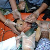 A boy affected by what activists say was a gas attack on the Syrian town of Telminnes receives treatment in the Bab al-Hawa hospital near the Turkish border in April 2014. | REUTERS