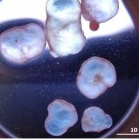 A Japanese team made these miniature bowels from human embryonic stem cells. Japanese team produces miniature bowels from embryonic stem cells