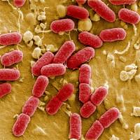 An undated image taken with electronic microscope shows EHEC bacteria (enterohemorrhagic Escherichia coli) in the Helmholtz Center for Infection Research in Brunswick, Germany. | REUTERS