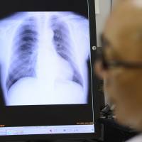 A doctor examines an X-ray image at a hospital in Tokyo. An informal survey by The Japan Times has found that many users of the Japanese health care system view it as affordable and of high quality but rife with impersonal doctors and hard to navigate. Japan's health care system edges foreign care in expat survey