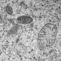 Mitochondria of varying sizes in an epithelial cell seen using an electron microscope. Osaka clinic reports five births from experimental IVF treatment, but some experts question safety
