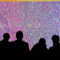 Cancer cells are shown on a screen connected to a microscope at the CeBit computer fair in Hanover, Germany, in March 2012. | REUTERS