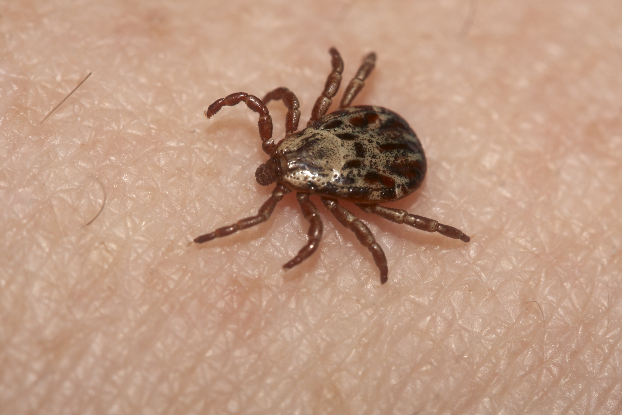 Medical experts are urging caution amid a rising number of potentially fatal infections that can be contracted through tick bites. | ISTOCK