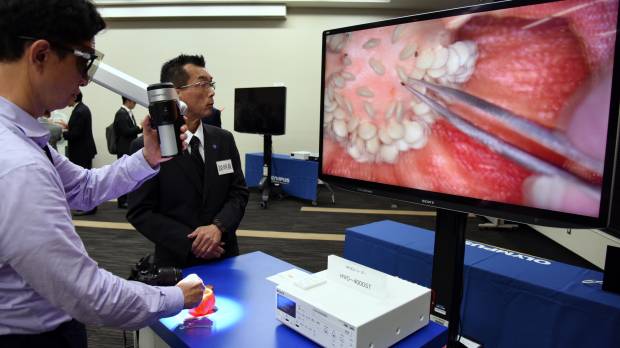 A reporter views sliced paprika using an advanced Orbeye microscope at a Sony Olympus Medical Solutions news conference on Tuesday. Sony-Olympus joint venture to market advanced HD surgical microscope
