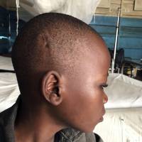 In this Aug. 29 photo made available by UNICEF, a boy displays a scar from a tracer bullet. in Mbuji Mayi, Kasai province, Democratic Republic of the Congo. Congo’s Kasai region is the latest deadly hotspot in the vast Central African country that has seen violent rebellions for decades. Once again, children are among the most vulnerable victims. Children getting increasingly caught up in growing violence in Congo's Kasai region