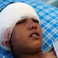 An wounded boy receives treatment inside a hospital, after a suicide attack at a checkpoint near the main cricket stadium, in Kabul Wednesday. Islamic State affiliate claims credit for suicide blast near Kabul cricket stadium that killed policeman, two others