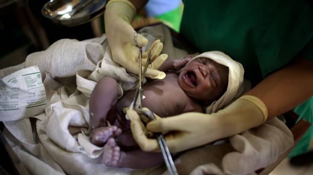 A midwife cuts the umbilical cord of a newborn baby at a public hospital in Yambio, South Sudan, in March 2014. Japan leads the world for low newborn mortality, but babies born in poorest countries still face 'alarming' risks: UNICEF