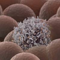 A cancer cell is shown together with healthy cells in this illustration. A joint Japanese research team plans to study how to detect cancer stem cells in the human body by making use of an ultra-precise observation sensor technology that is being used in the Hitomi astronomy satellite. JAXA, University of Tokyo deploy satellite sensor technology against cancer