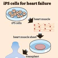 Japan OKs first clinical study of iPS cell-based heart treatment