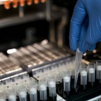 Consumer DNA tests are gaining popularity in aging Japan. Home DNA testing gains popularity in aging Japan