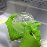 We’re bigger, but they outnumber us. New weapons in war against antibiotic-resistant bacteria